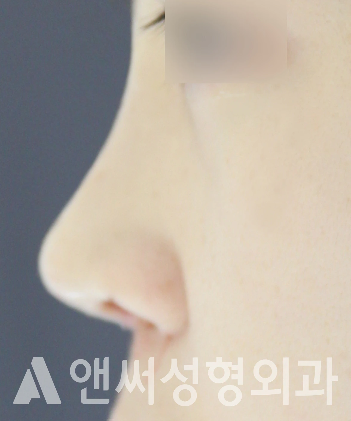 Answer Plastic Surgery case 607: After