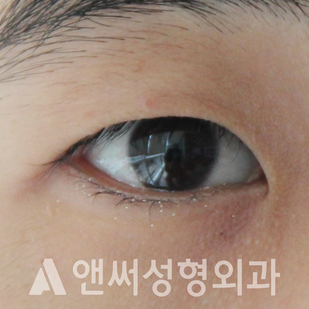 Answer Plastic Surgery case 606: Before