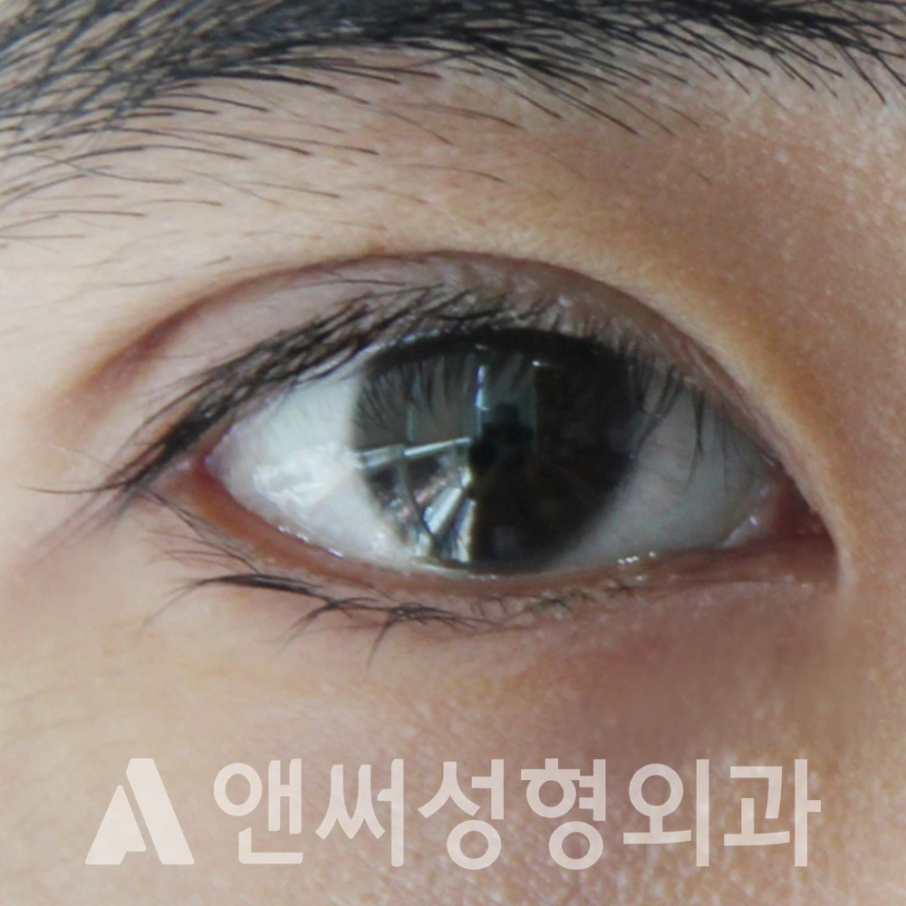 Answer Plastic Surgery case 606: After