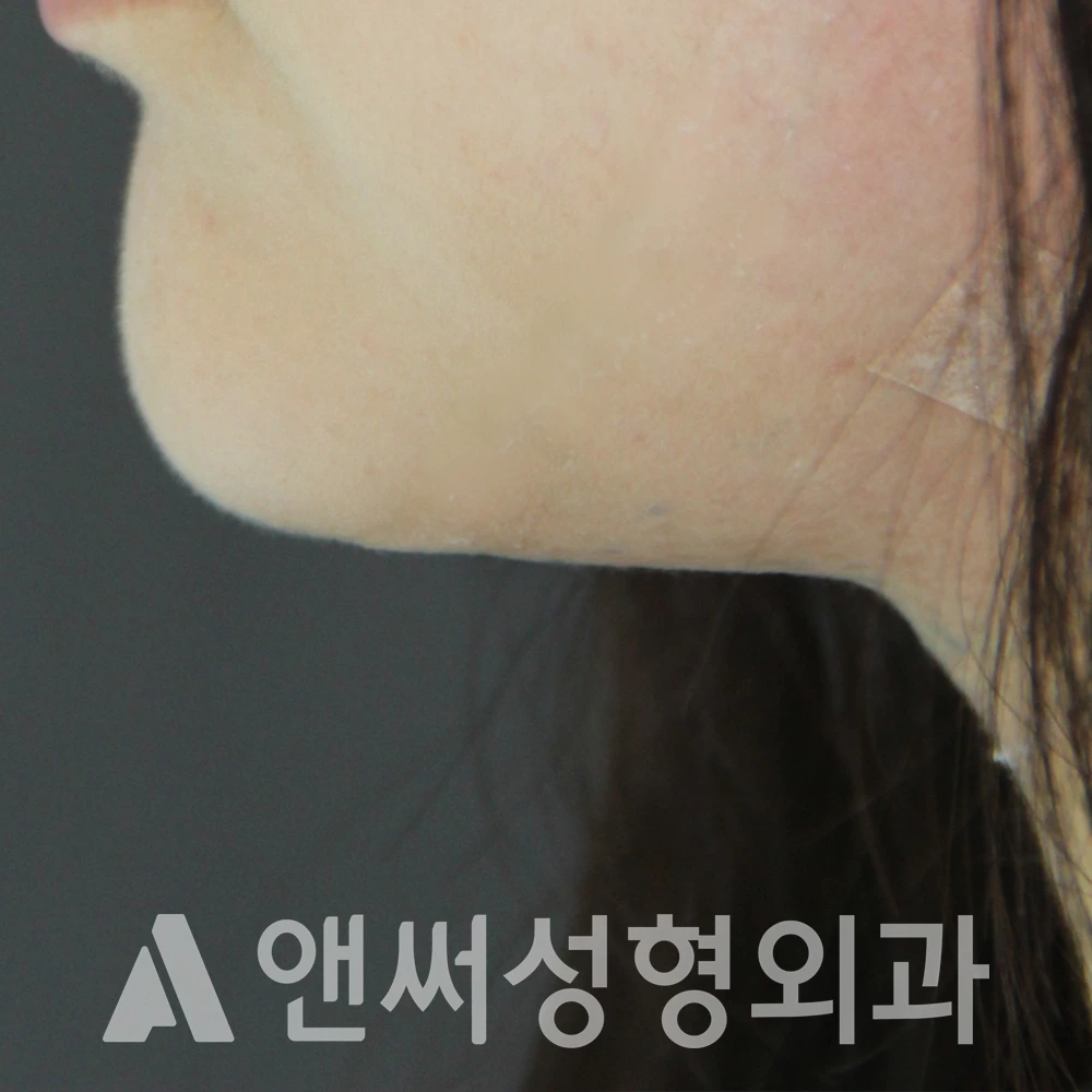 Answer Plastic Surgery case 605: After