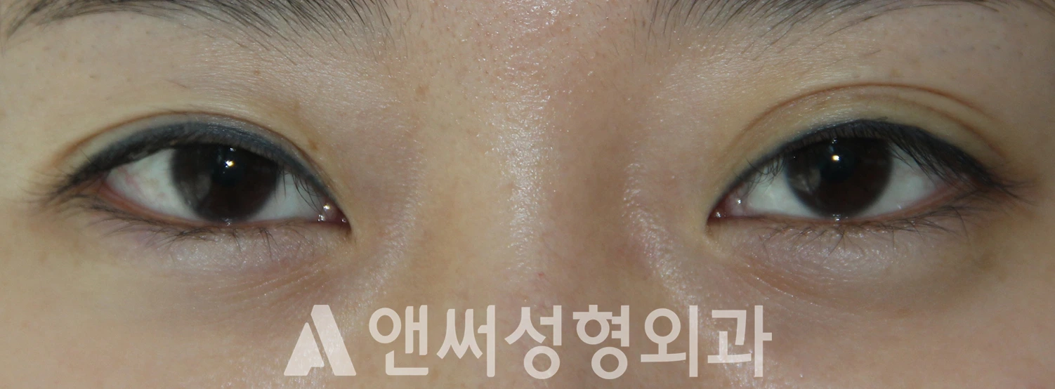 Answer Plastic Surgery case 604: Before