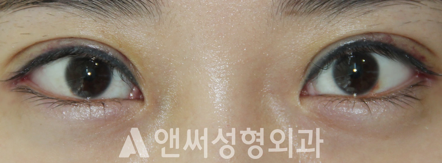 Answer Plastic Surgery case 604: After