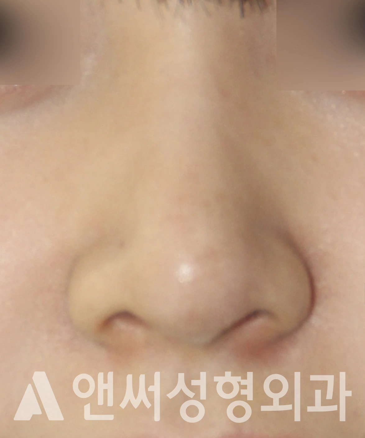 Answer Plastic Surgery case 603: After