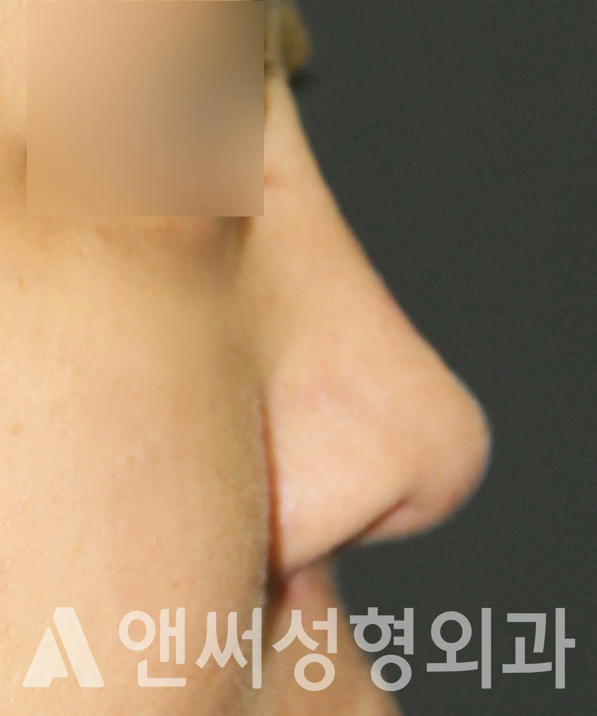 Answer Plastic Surgery case 602: After