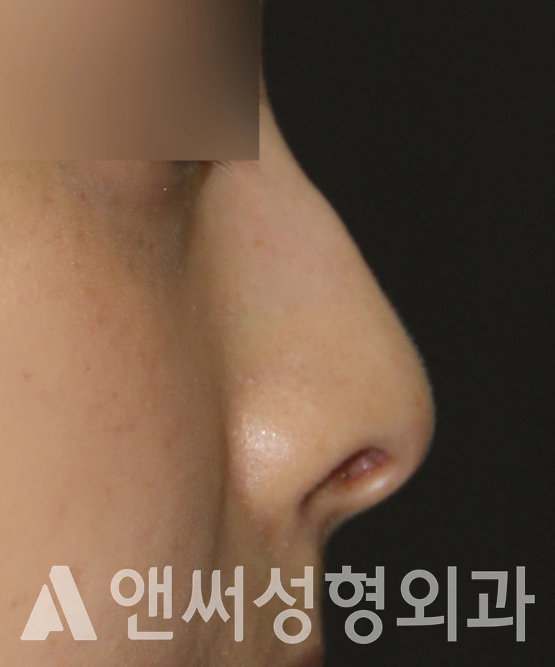 Answer Plastic Surgery case 601: Before
