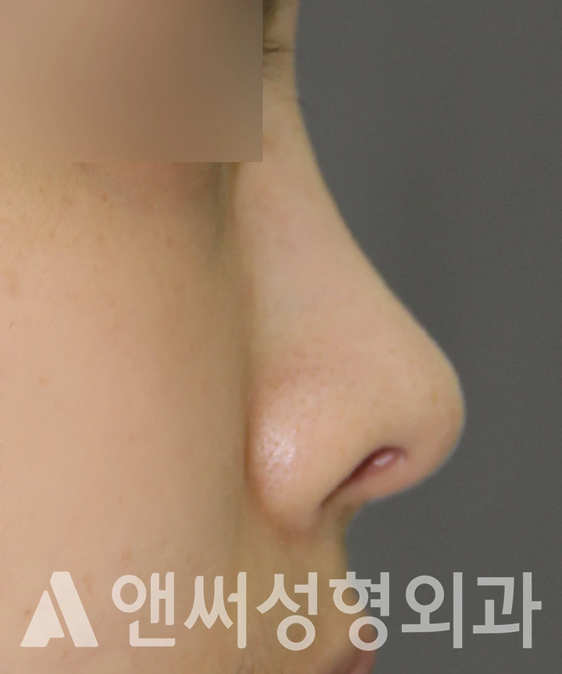 Answer Plastic Surgery case 601: After