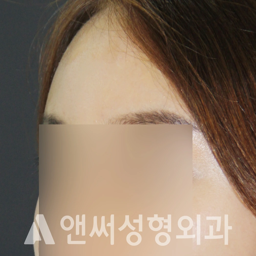Answer Plastic Surgery case 600: After
