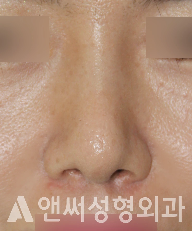 Answer Plastic Surgery case 599: After