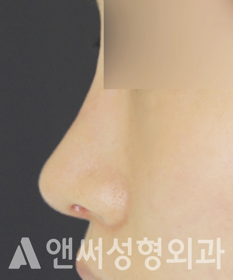 Answer Plastic Surgery case 598: After