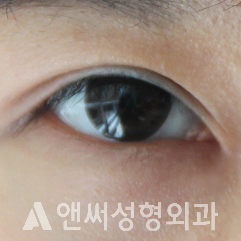 Answer Plastic Surgery case 597: After