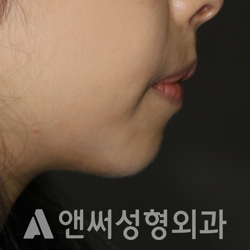 Answer Plastic Surgery case 596: Before