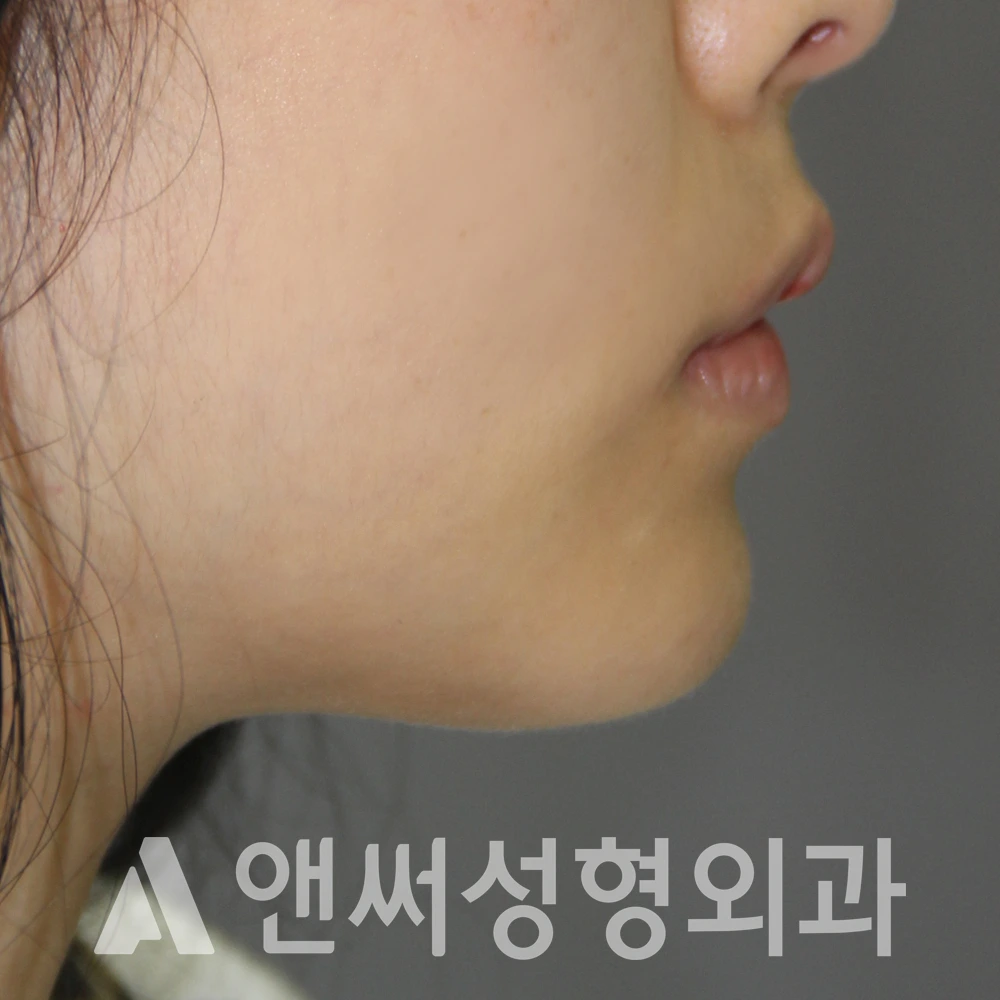 Answer Plastic Surgery case 596: After
