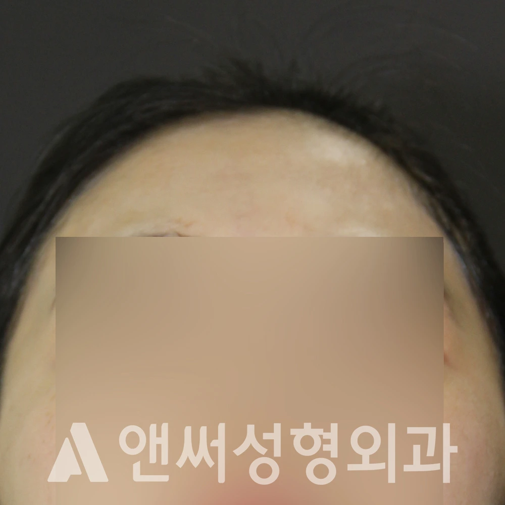 Answer Plastic Surgery case 595: Before