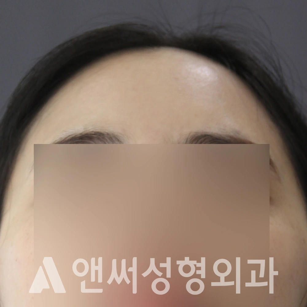 Answer Plastic Surgery case 595: After