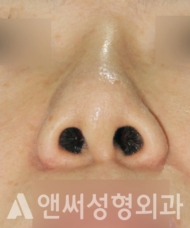 Answer Plastic Surgery case 594: Before
