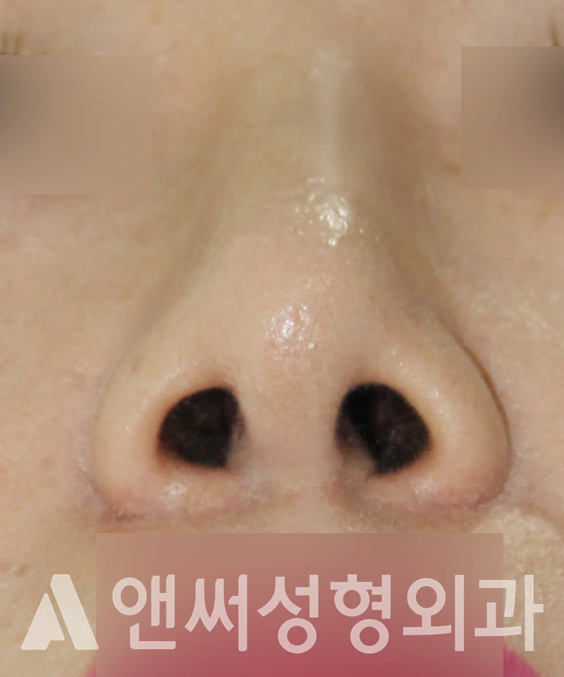 Answer Plastic Surgery case 594: After