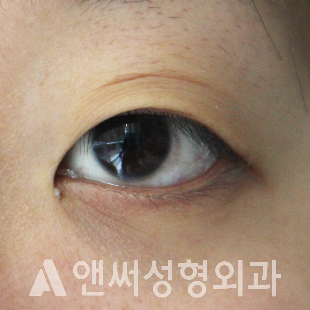 Answer Plastic Surgery case 593: Before