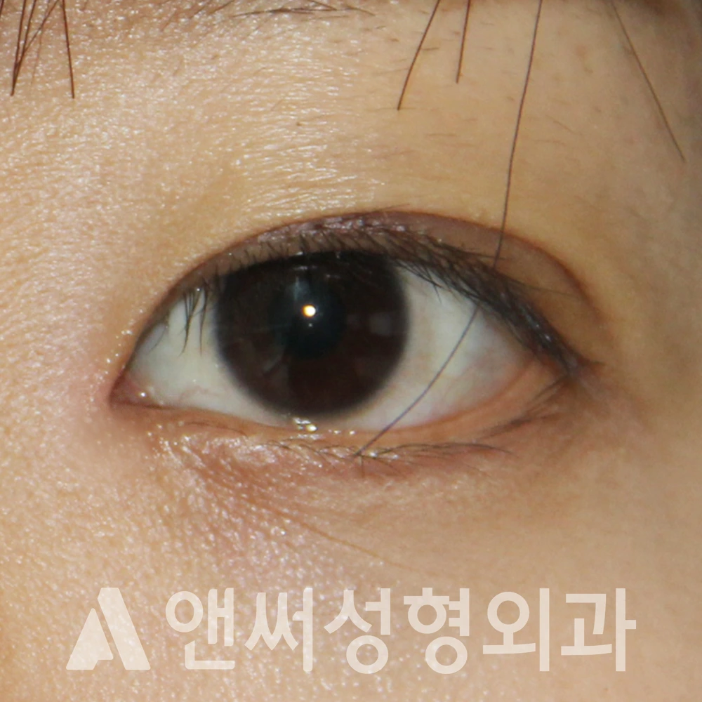 Answer Plastic Surgery case 593: After