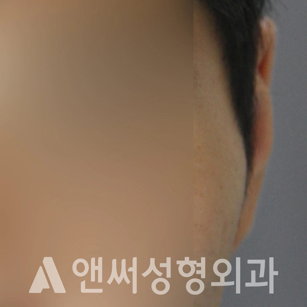 Answer Plastic Surgery case 592: Before