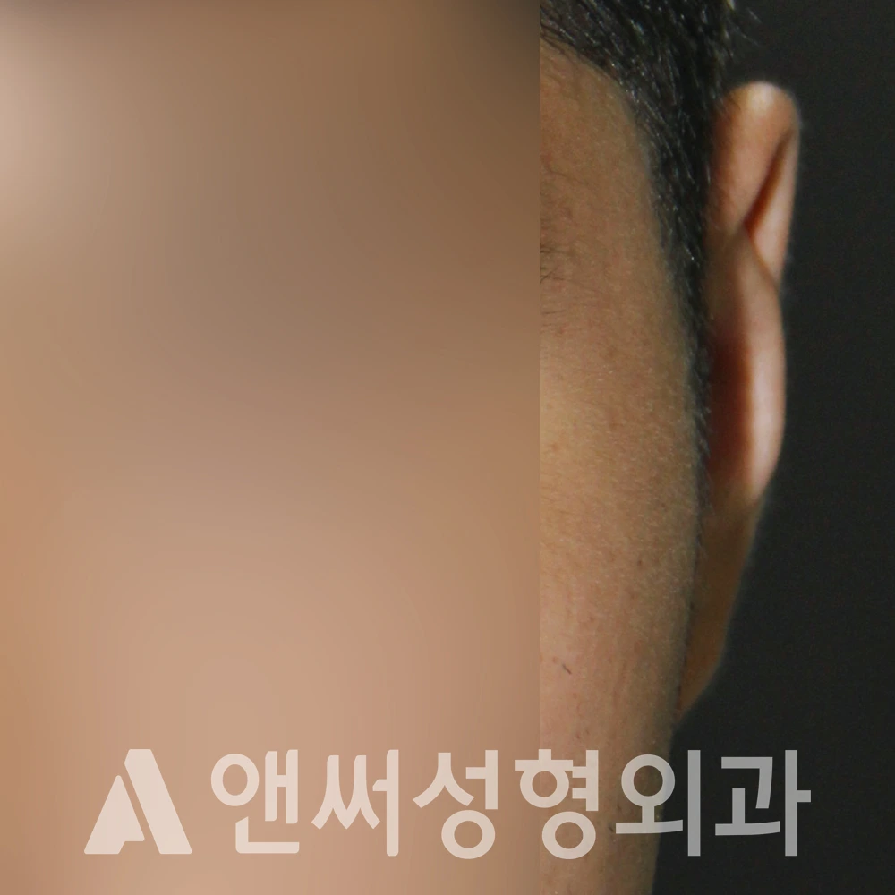 Answer Plastic Surgery case 592: After