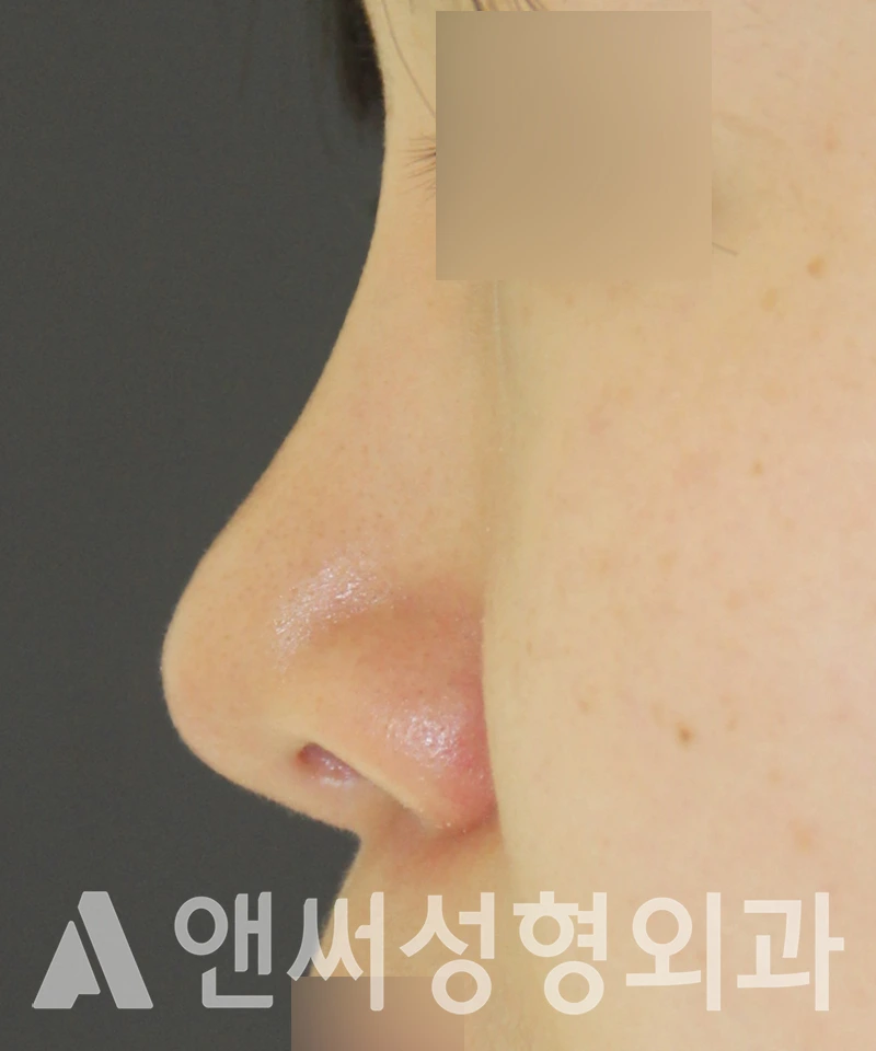 Answer Plastic Surgery case 591: After