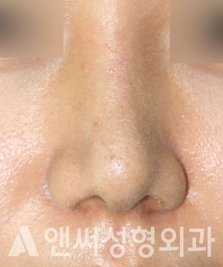 Answer Plastic Surgery case 590: After