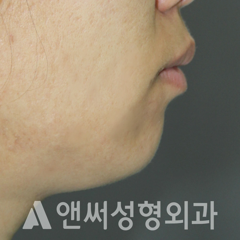 Answer Plastic Surgery case 589: Before