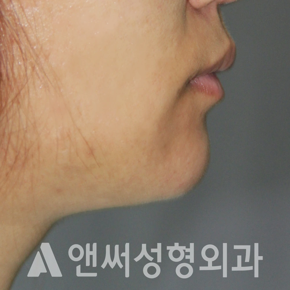 Answer Plastic Surgery case 589: After