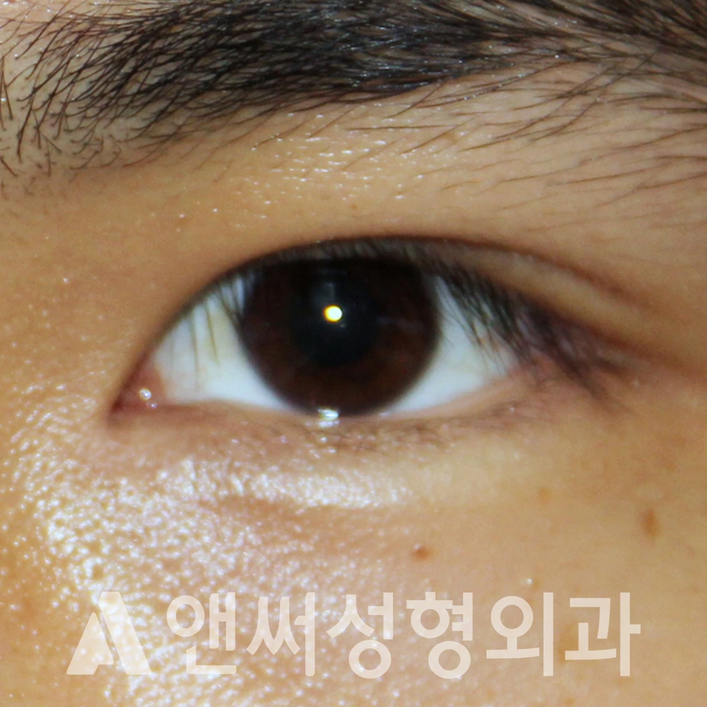 Answer Plastic Surgery case 588: After