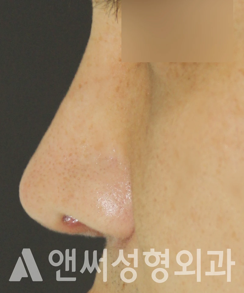 Answer Plastic Surgery case 587: After