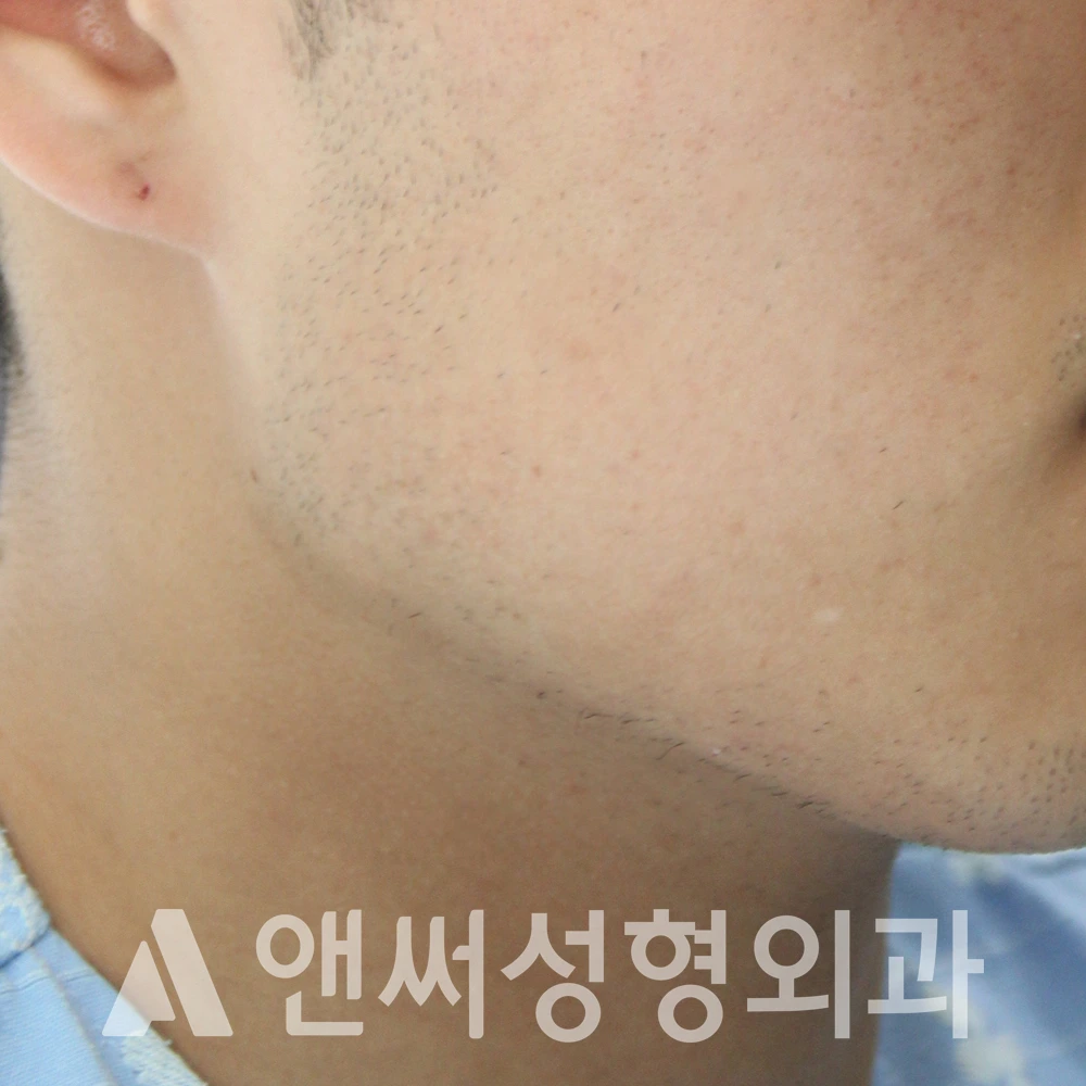 Answer Plastic Surgery case 586: Before