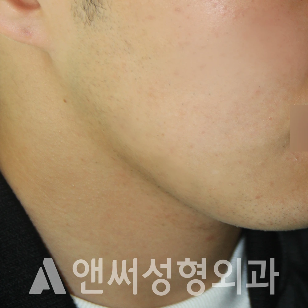 Answer Plastic Surgery case 586: After