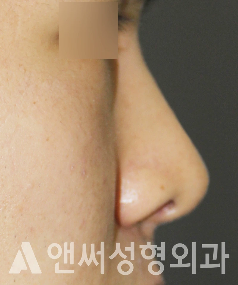 Answer Plastic Surgery case 584: After