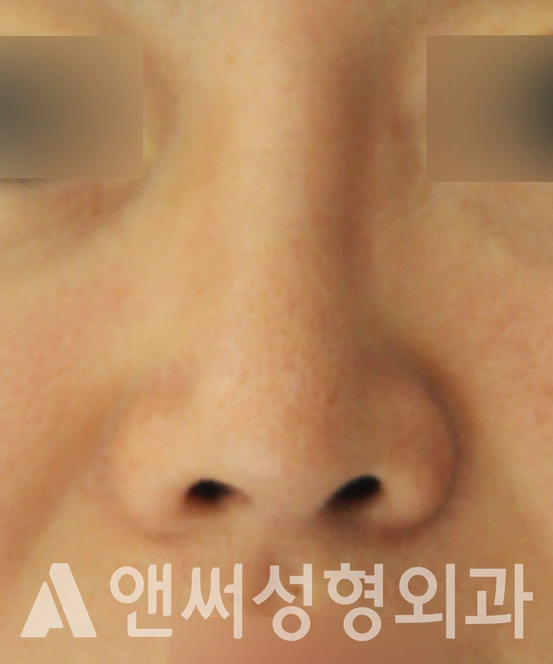 Answer Plastic Surgery case 583: After