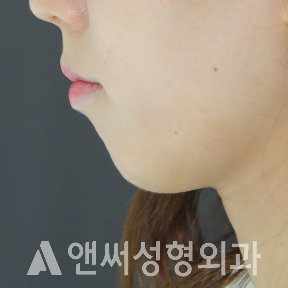 Answer Plastic Surgery case 582: Before