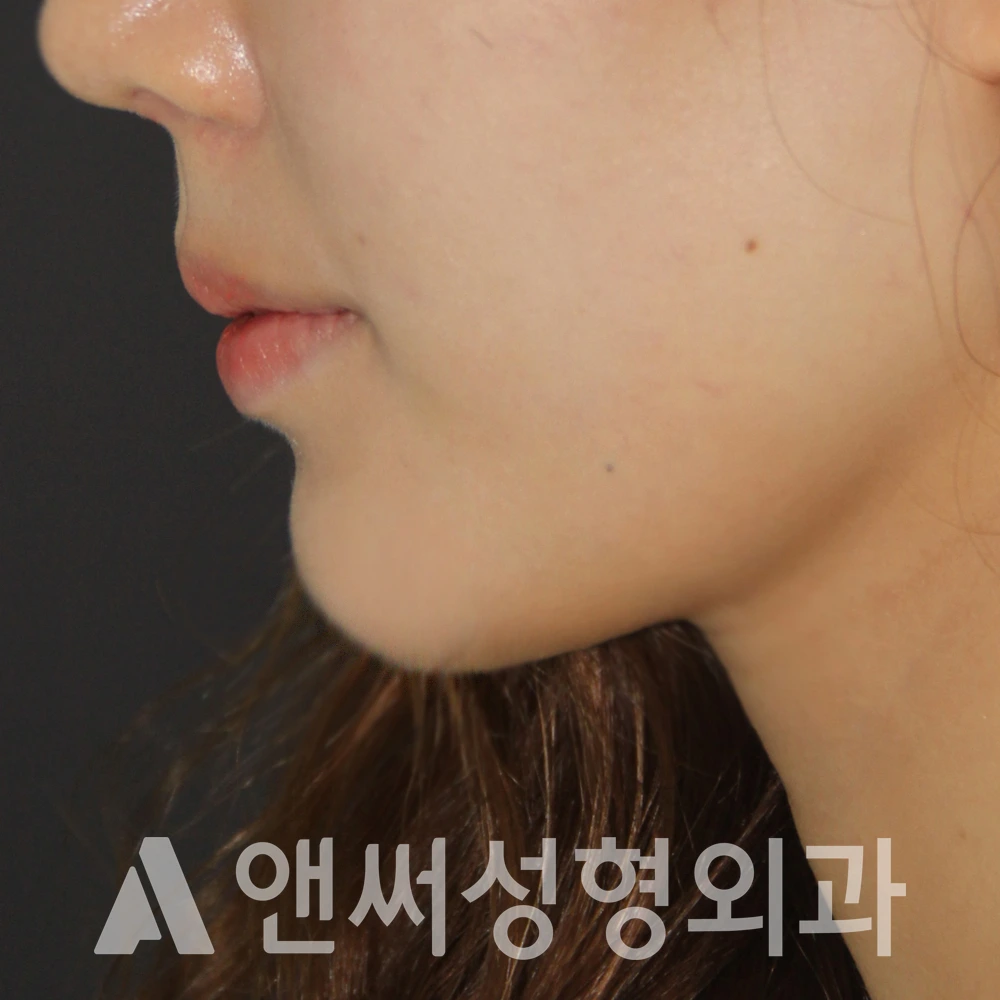 Answer Plastic Surgery case 582: After