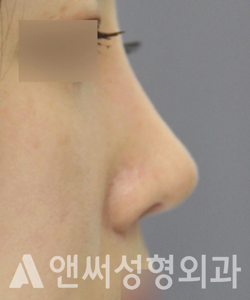 Answer Plastic Surgery case 581: After