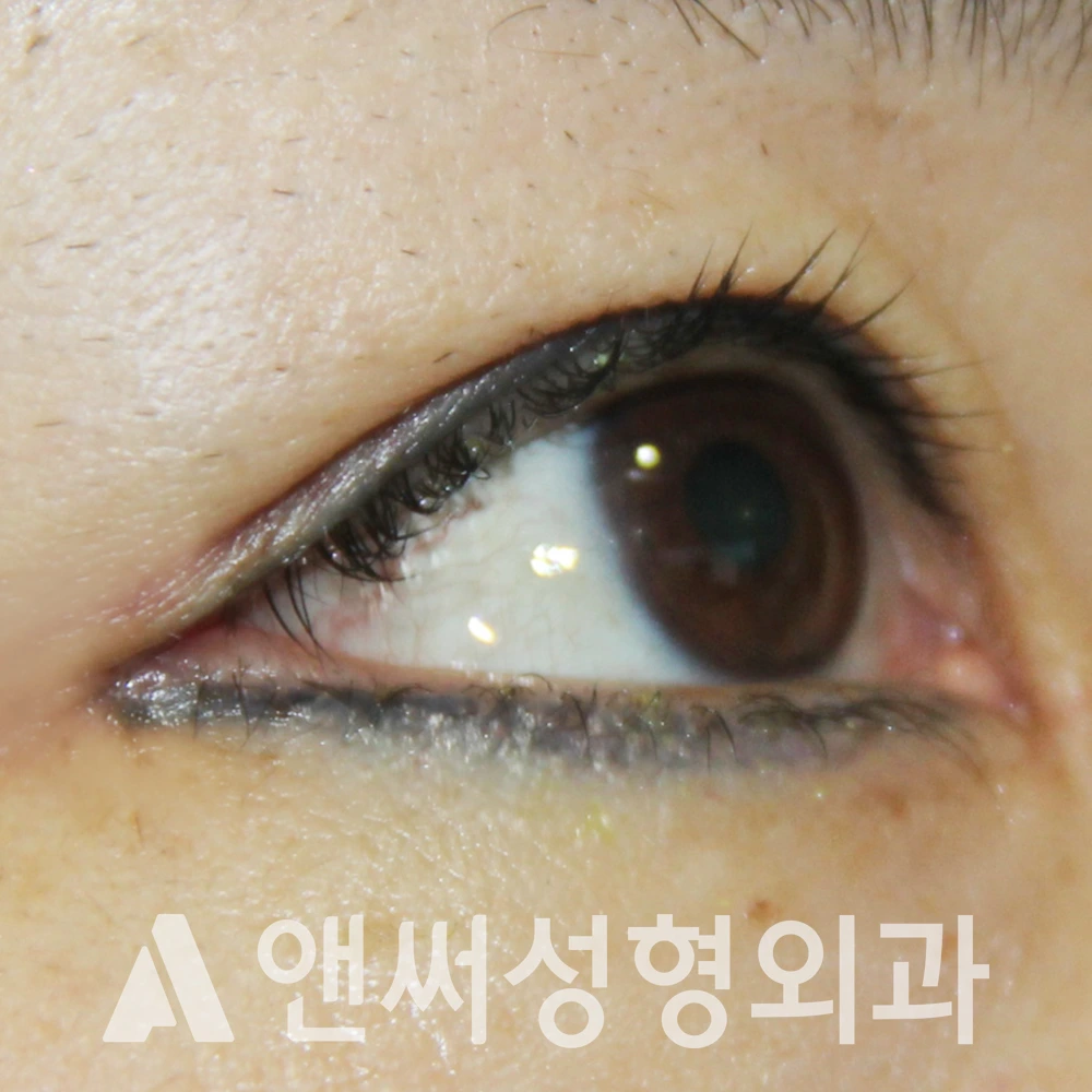 Answer Plastic Surgery case 580: After