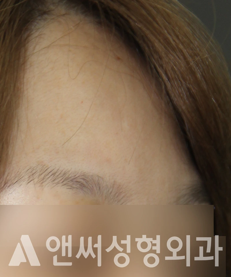 Answer Plastic Surgery case 579: Before