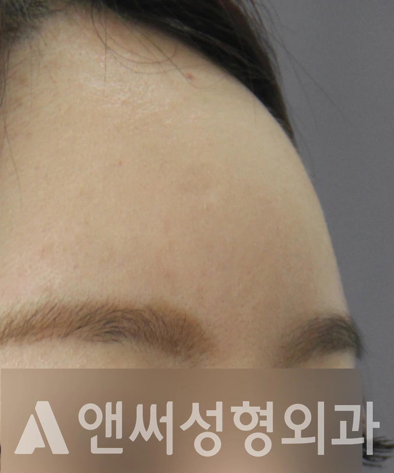 Answer Plastic Surgery case 579: After