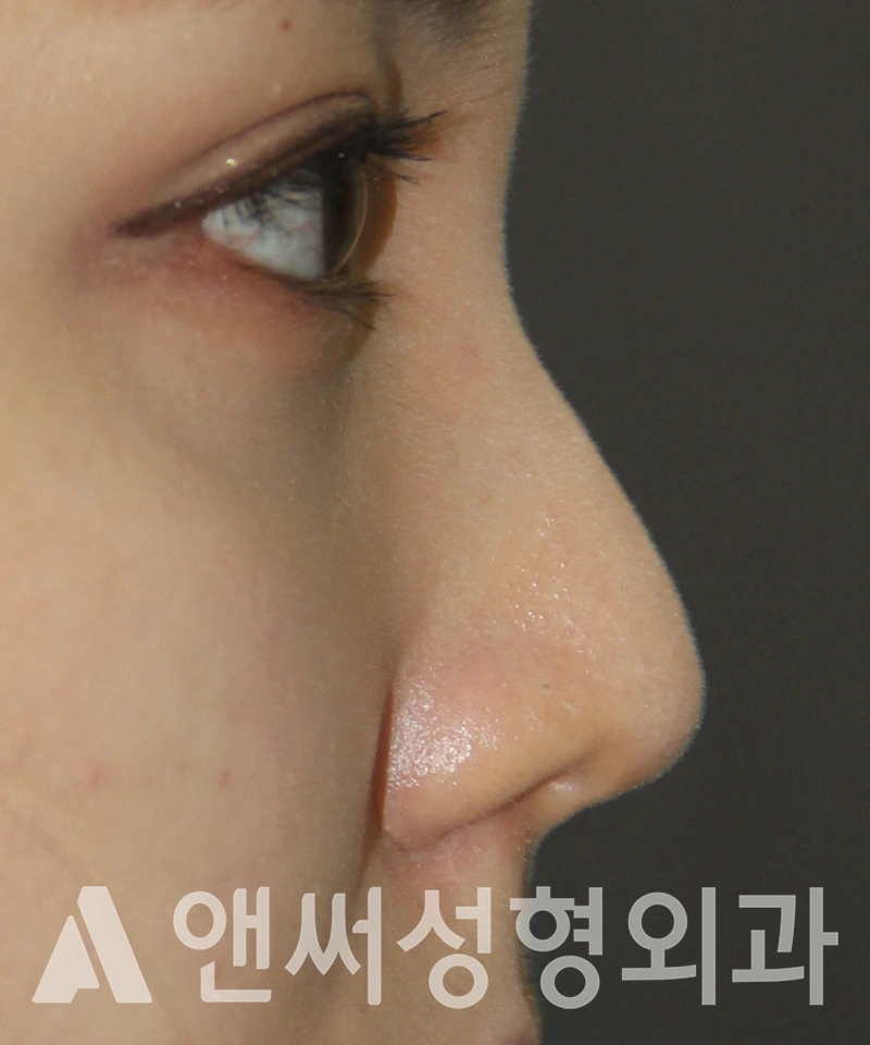 Answer Plastic Surgery case 578: Before