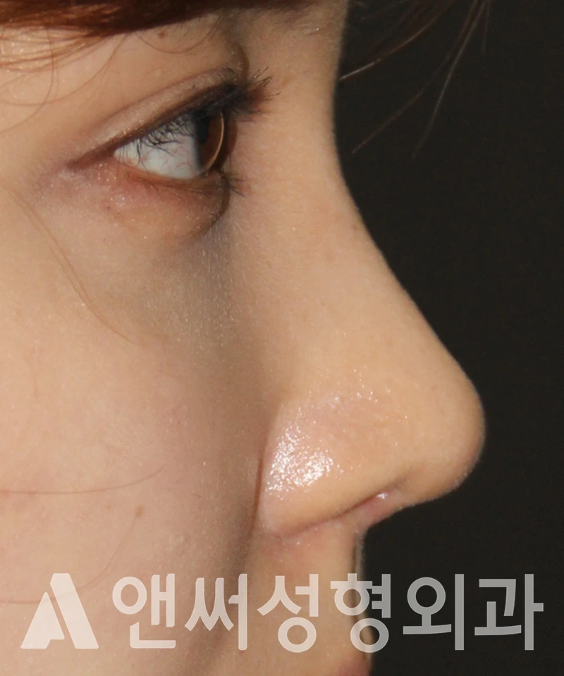 Answer Plastic Surgery case 578: After