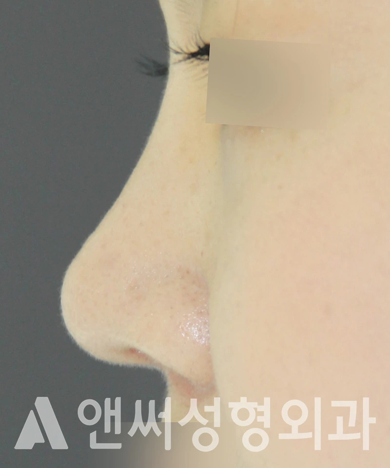 Answer Plastic Surgery case 577: After