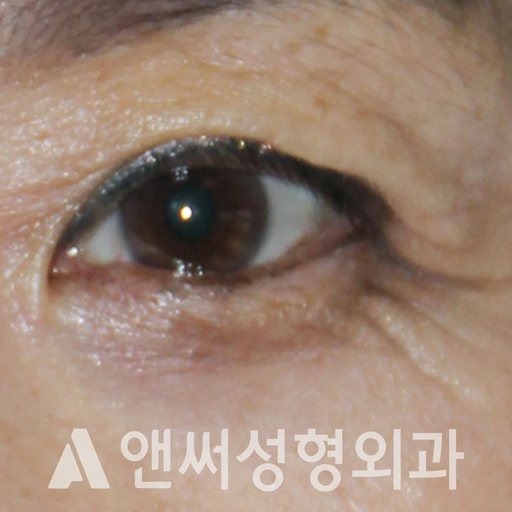 Answer Plastic Surgery case 548: Before