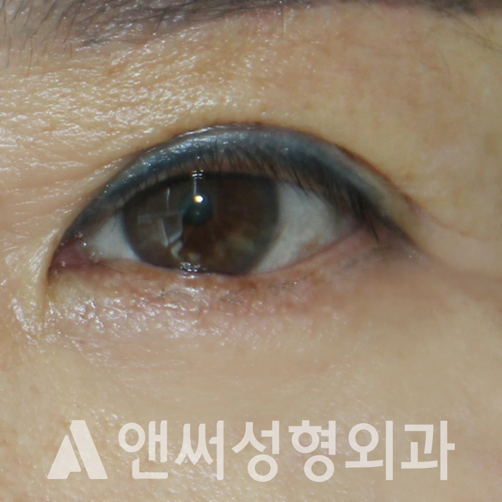 Answer Plastic Surgery case 548: After