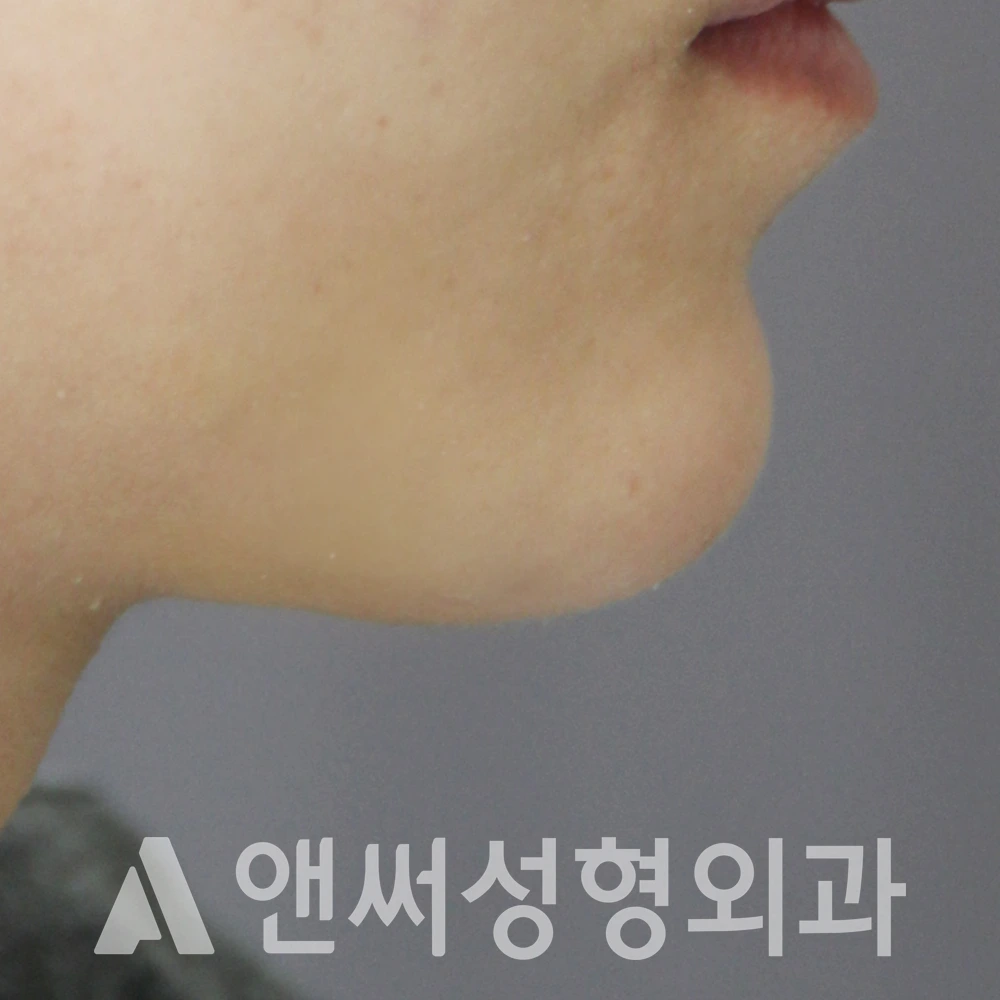 Answer Plastic Surgery case 552: After