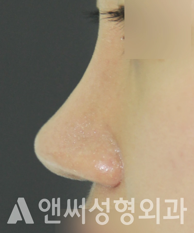 Answer Plastic Surgery case 551: After