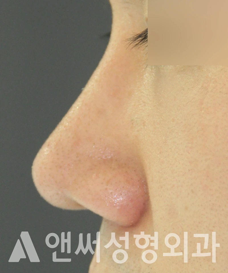 Answer Plastic Surgery case 550: After