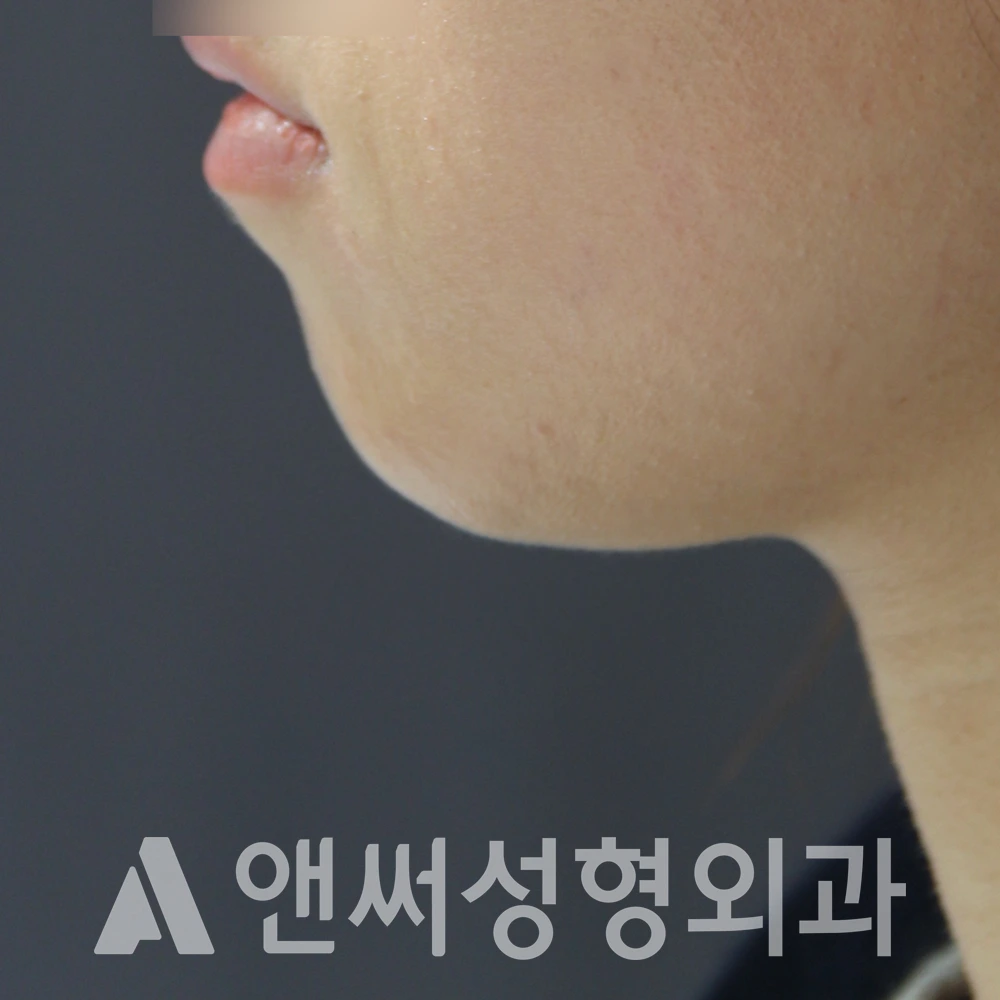 Answer Plastic Surgery case 549: Before