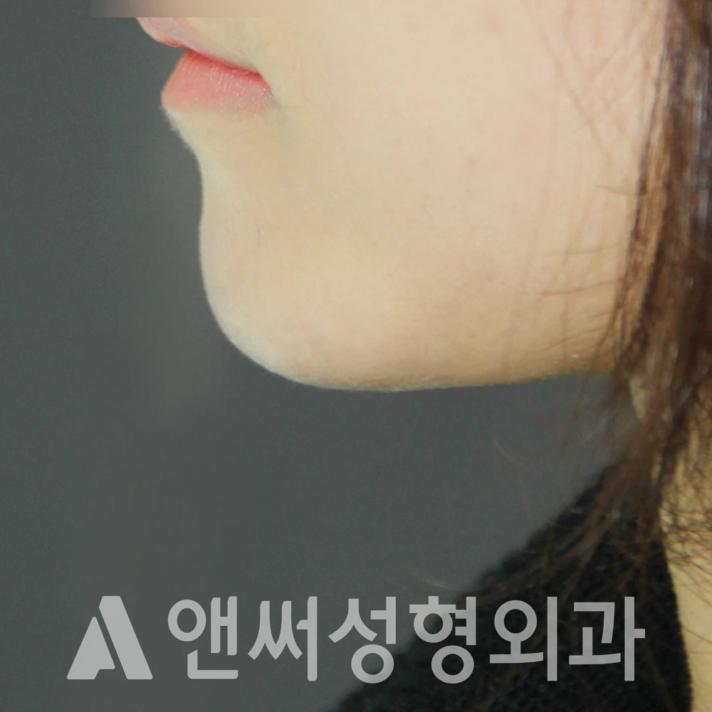 Answer Plastic Surgery case 549: After